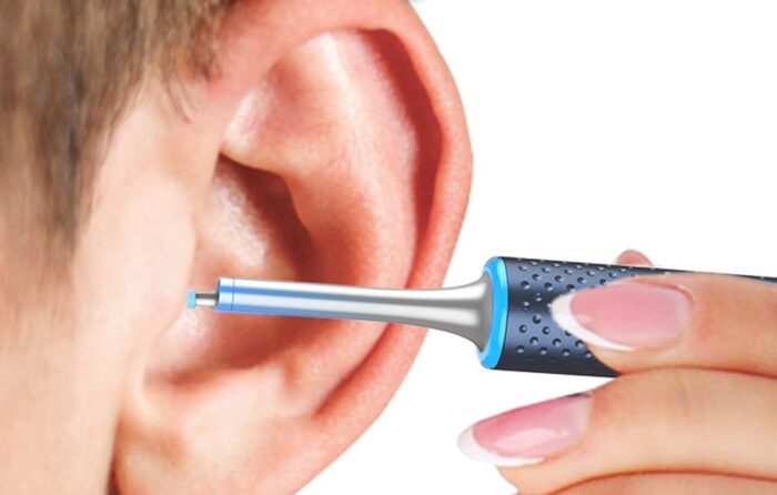 Smart Visual Ear-Clean Rod Bebird M9 S (black) - Image 6